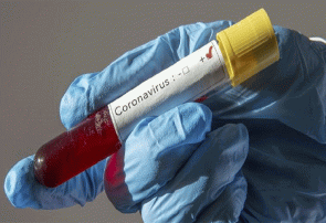 کشف ژنوم ویروس کرونا توسط دانشمندان روسی